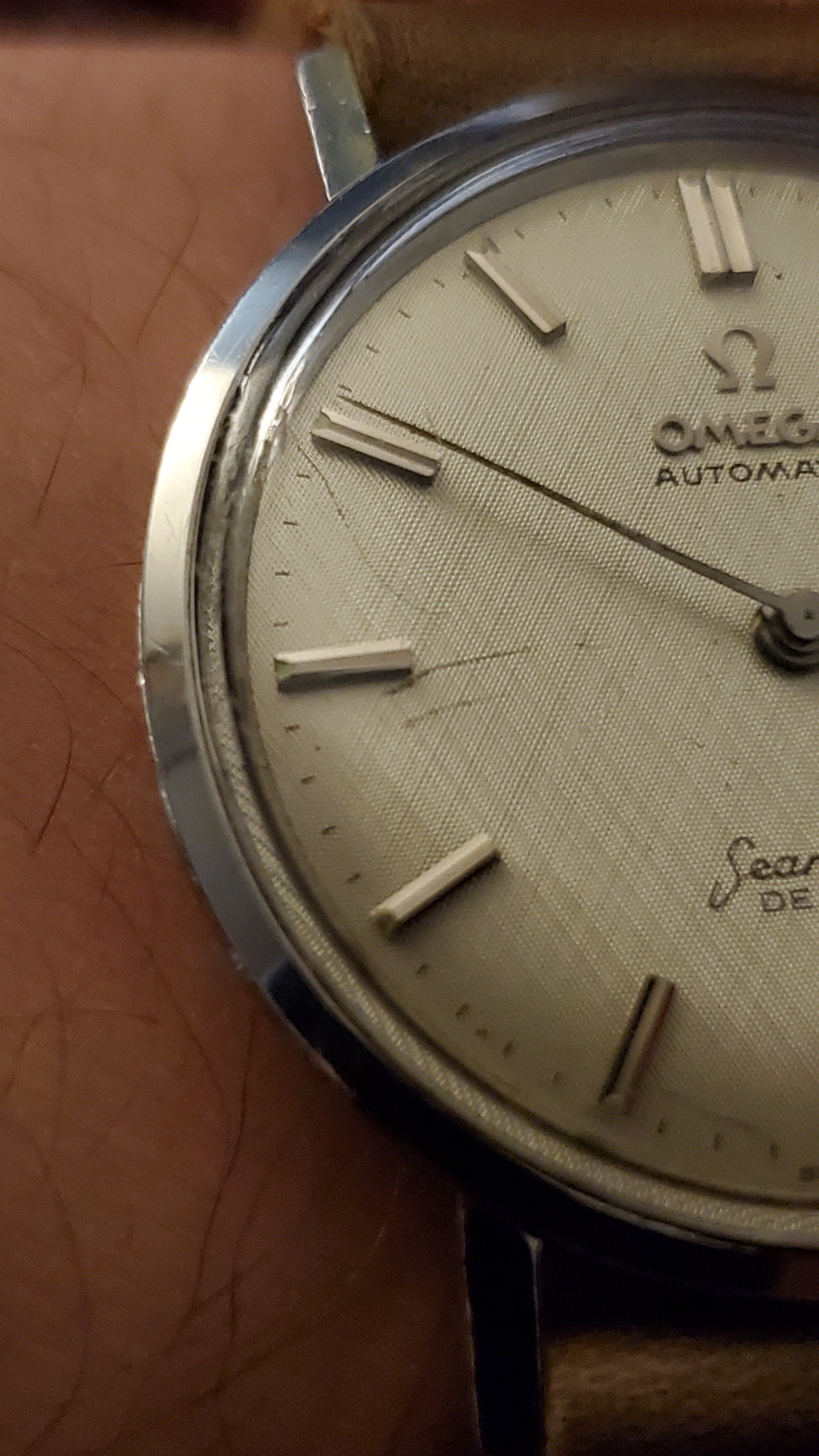 Scratches on watch