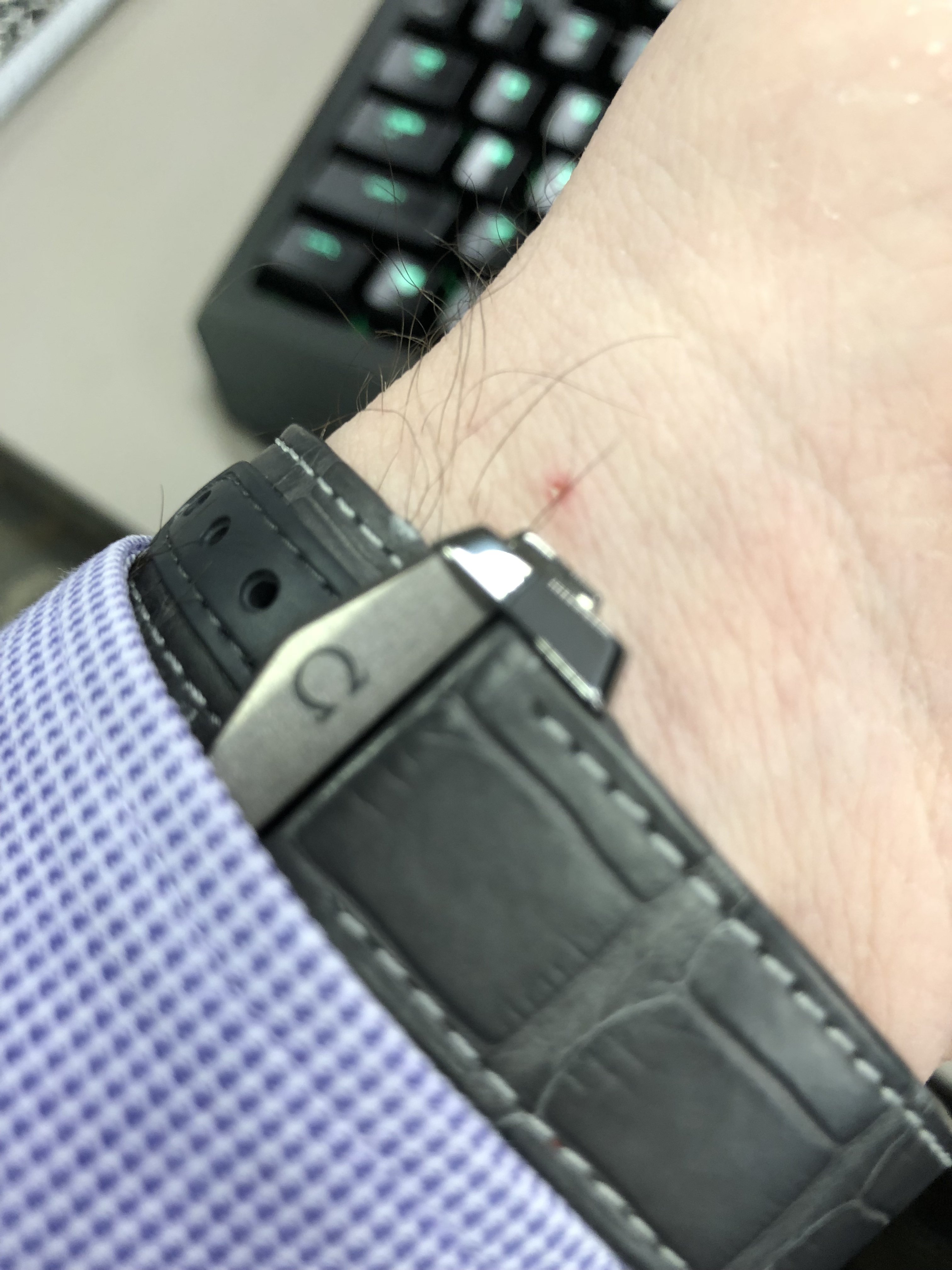 Ceramic deployant cuts my wrist Omega Forums