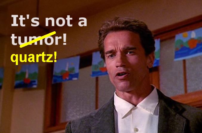 Its not a tumor quartz.jpg Its not a tumor quartz.jpg