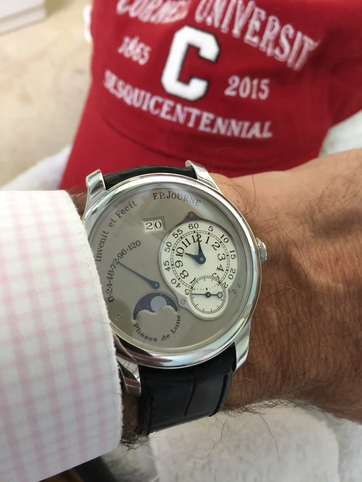 FPJ wrist.webp