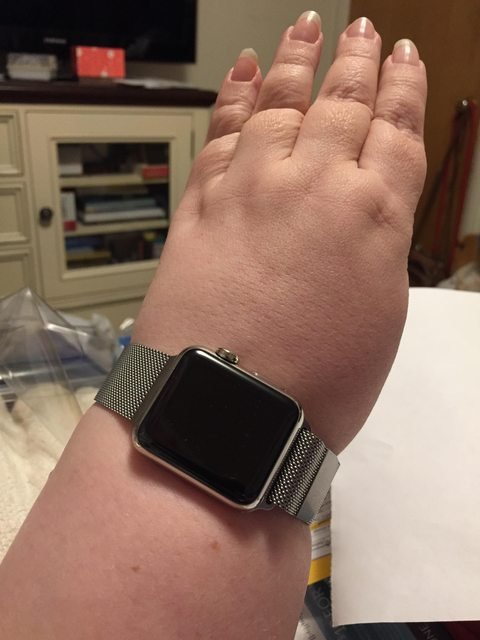 FatWrist.jpg