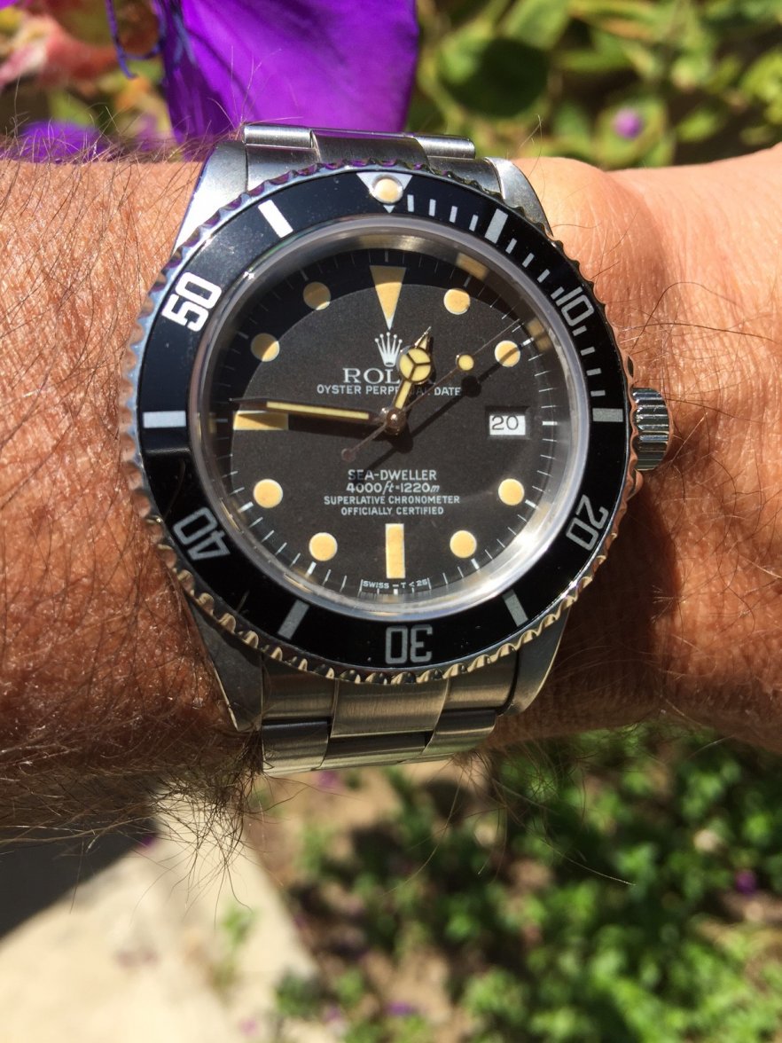 SD wrist 7.17.JPG