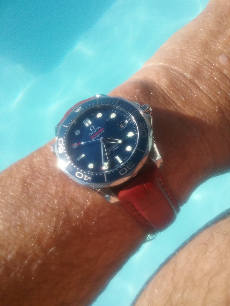 watch rotates on wrist